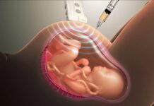 Что такое инвазивная пренатальная диагностика