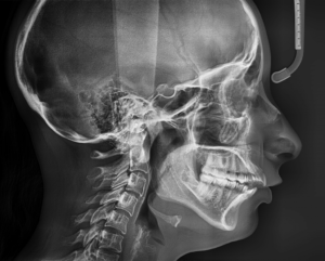 Телерентгенограмма - что за процедура и для чего она делается
