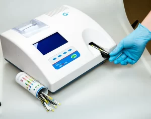 Анализаторы мочи - что за оборудование, функции и виды