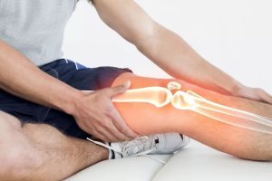 Как правильно выбрать витамины для поддержки здоровья суставов