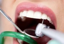 Какие современные стоматологические материалы используются при лечении кариеса?