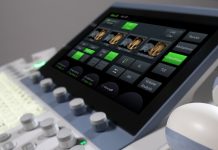 GE healthcare узи аппарат и его особенности