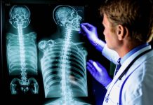 Методі лікування сколіозу