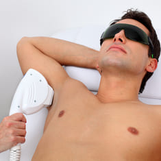 Лазерная эпиляция у мужчин: мифы и реальность