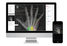 DICOM-вьюер и его использование